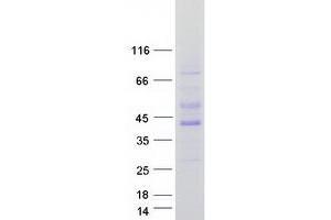 Image no. 1 for Protein Kinase, AMP-Activated, beta 1 Non-Catalytic Subunit (PRKAB1) protein (Myc-DYKDDDDK Tag) (ABIN2714672)