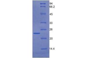 Image no. 3 for Growth Arrest-Specific 6 (GAS6) ELISA Kit (ABIN6720504)