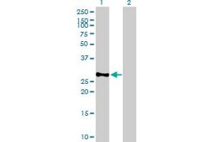 Western Blot analysis of BCAP31 expression in transfected 293T cell line by BCAP31 MaxPab polyclonal antibody.