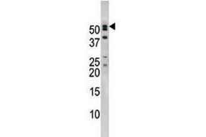 Image no. 2 for anti-Nucleoporin 50kDa (NUP50) (C-Term) antibody (ABIN357219)