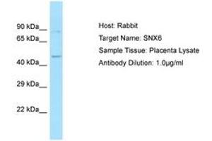 Image no. 1 for anti-Sorting Nexin 6 (SNX6) (AA 208-257) antibody (ABIN6749999)