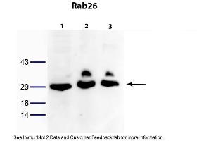 Image no. 2 for anti-RAB26, Member RAS Oncogene Family (RAB26) (N-Term) antibody (ABIN2786016)