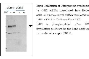 Image no. 5 for anti-Denticleless E3 Ubiquitin Protein Ligase Homolog (DTL) (C-Term) antibody (ABIN2451940)