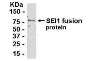 Image no. 1 for anti-SERTA Domain Containing 1 (SERTAD1) (AA 1-236) antibody (ABIN2468083)