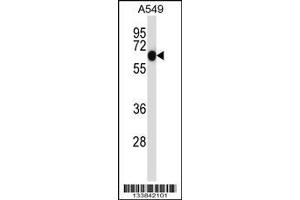 Image no. 1 for anti-Alkaline Phosphatase, Placental-Like 2 (ALPPL2) (AA 58-86), (N-Term) antibody (ABIN657475)
