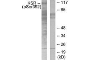 Western blot analysis of extracts from HepG2 cells, using KSR (Phospho-Ser392) Antibody.