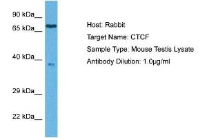 Image no. 2 for anti-CCCTC-Binding Factor (Zinc Finger Protein) (CTCF) (C-Term) antibody (ABIN2777204)