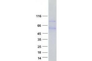 Image no. 1 for Proline Arginine Rich End Leucine Rich Repeat Protein (PRELP) (Transcript Variant 2) protein (Myc-DYKDDDDK Tag) (ABIN2729749)