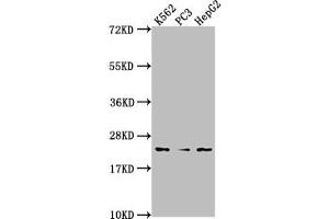 BLVRB Antikörper  (AA 2-206)