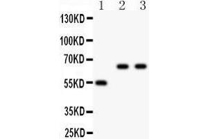 Image no. 4 for anti-Cytochrome P450, Family 2, Subfamily E, Polypeptide 1 (CYP2E1) (AA 1-310) antibody (ABIN3043821)