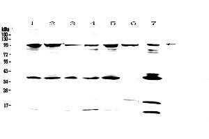 Image no. 1 for anti-Feline Sarcoma Oncogene (FES) antibody (ABIN5693321)