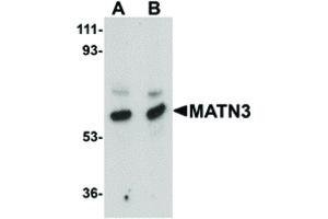 Matrilin 3 antibody  (Internal Region)