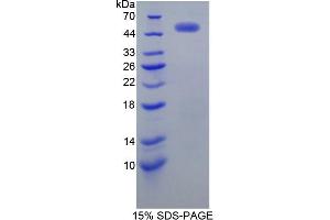 Image no. 3 for Receptor tyrosine-protein kinase erbB-2 (ErbB2/Her2) ELISA Kit (ABIN6730948)