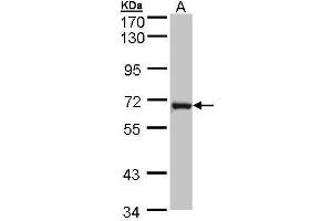 Image no. 2 for anti-DENN/MADD Domain Containing 1B (DENND1B) (Center) antibody (ABIN2856495)