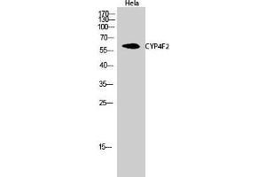 Image no. 2 for anti-Cytochrome P450, Family 4, Subfamily F, Polypeptide 2 (CYP4F2) (N-Term) antibody (ABIN3184201)