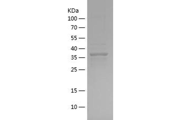 Afamin Protein (AFM) (AA 22-143) (His-IF2DI Tag)