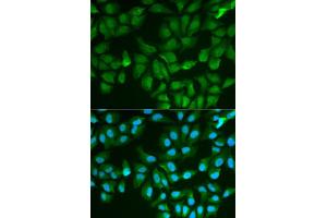 Image no. 6 for anti-Galectin 3 (LGALS3) (pSer3) antibody (ABIN1513152)
