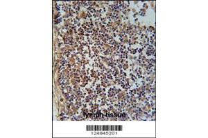 Immunohistochemistry (IHC) image for anti-Family with Sequence Similarity 49, Member A (FAM49A) antibody (ABIN2158790)