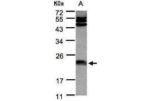 Image no. 3 for anti-Ferritin, Light Polypeptide (FTL) (Center) antibody (ABIN2854973)