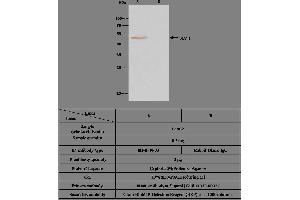 Image no. 2 for anti-Bleomycin Hydrolase (BLMH) (AA 2-455) antibody (ABIN1998709)