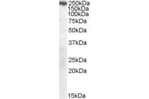 Image no. 2 for anti-Sortilin-Related Receptor, L(DLR Class) A Repeats Containing (SORL1) (C-Term) antibody (ABIN184579)