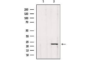 Image no. 1 for anti-Glycoprotein Ib (Platelet), beta Polypeptide (GP1BB) antibody (ABIN6262037)
