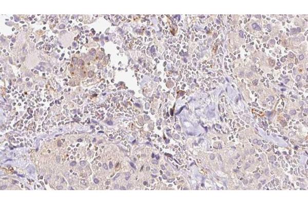 RLBP1 antibody  (Internal Region)