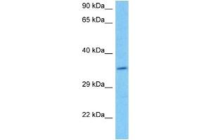 Image no. 2 for anti-Deleted in Azoospermia-Like (DAZL) (C-Term) antibody (ABIN2778768)