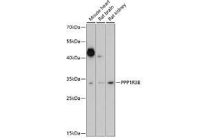 Western blot analysis of extracts of various cell lines, using PPP1R3B antibody (ABIN7269678) at 1:1000 dilution.