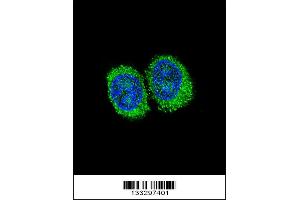 Image no. 3 for anti-Niemann-Pick Disease, Type C1 (NPC1) (Center) antibody (ABIN2447143)