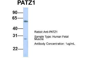 Image no. 2 for anti-Zinc Finger Protein 278 (ZNF278) (N-Term) antibody (ABIN2779693)