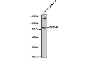 Image no. 1 for anti-Zinc Finger Protein 549 (ZNF549) antibody (ABIN4905684)