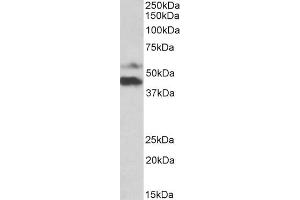 ABIN5539924 (1µg/ml) staining of Human Colorectal Cancer lysate (35µg protein in RIPA buffer).