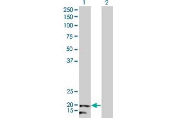 anti-NADH Dehydrogenase (Ubiquinone) 1 beta Subcomplex, 5, 16kDa (NDUFB5) (AA 95-189) antibody