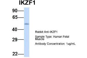 Image no. 1 for anti-IKAROS Family Zinc Finger 1 (Ikaros) (IKZF1) (Middle Region) antibody (ABIN2777317)