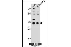 Image no. 1 for anti-Signal Sequence Receptor, alpha (SSR1) (AA 17-46), (N-Term) antibody (ABIN5532147)