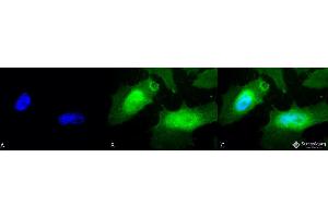 Image no. 2 for anti-Heat Shock 27kDa Protein 2 (HSPB2) antibody (HRP) (ABIN2486042)