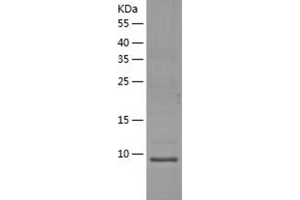 CD164L2 Protein (AA 30-141) (His tag)