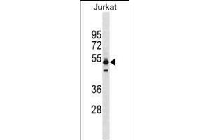 TO Antibody (Center) (ABIN1538173 and ABIN2838131) western blot analysis in Jurkat cell line lysates (35 μg/lane).