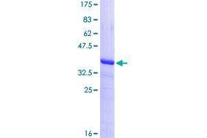 Image no. 1 for BTB (POZ) Domain Containing 2 (BTBD2) (AA 422-503) protein (GST tag) (ABIN1346928)