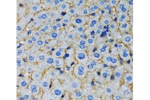 Immunohistochemistry of paraffin-embedded Rat liver using RAF1 Polyclonal Antibody at dilution of 1:100 (40x lens).