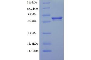 EMC9 Protein (ER Membrane Protein Complex Subunit 9) (AA 1-208, full length) (His-SUMO Tag)