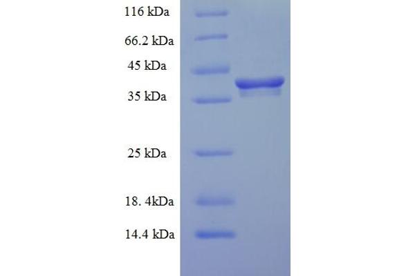EMC9 Protein (ER Membrane Protein Complex Subunit 9) (AA 1-208, full length) (His-SUMO Tag)
