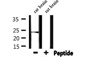 Image no. 3 for anti-Heat Shock 27kDa Protein 2 (HSPB2) (Internal Region) antibody (ABIN6258481)