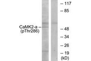 Western blot analysis of extracts from K562 cells, using CaMK2 (Phospho-Thr286) Antibody.