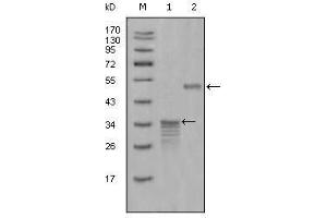 Image no. 1 for anti-Secretoglobin, Family 2A, Member 2 (SCGB2A2) (AA 1-193) antibody (ABIN931438)