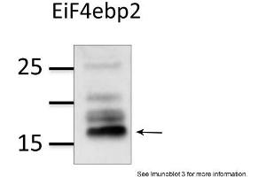 Image no. 3 for anti-Eukaryotic Translation Initiation Factor 4E Binding Protein 2 (EIF4EBP2) (N-Term) antibody (ABIN2784743)