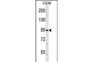 Image no. 1 for anti-Family with Sequence Similarity 38, Member B (FAM38B) (AA 2575-2604) antibody (ABIN5536472)
