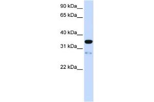 Image no. 1 for anti-Transmembrane Protein 38A (TMEM38A) (N-Term) antibody (ABIN2783911)