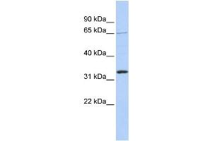 Image no. 2 for anti-Grainyhead-Like 2 (GRHL2) (Middle Region) antibody (ABIN2778358)